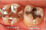 口の中には毒がある！？